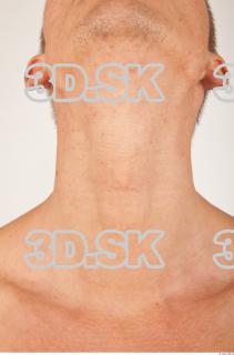 Neck texture of Alton 0001